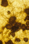 Image of diseased sorghum under a microscope